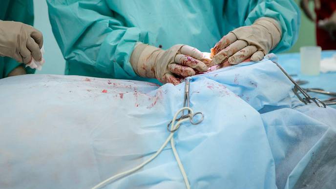 AVF Creation Linked with Slower Decline in Kidney Function
