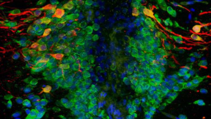 Parkinson’s Gene PINK1 May Impair How New Neurons Are Made Throughout Our Lifetime