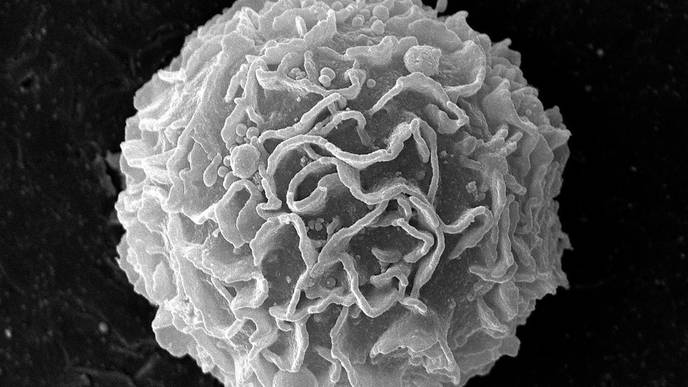 Probiotic Bacteria Shown to Suppress Growth of Tumors in Colorectal Cancer