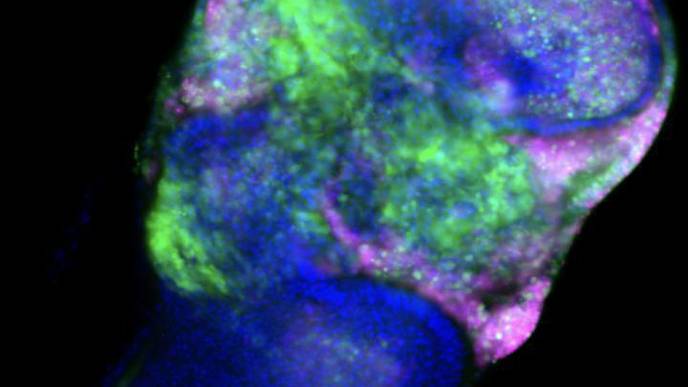 Dietary Amino Acid Determines the Fate of Cancer Cells