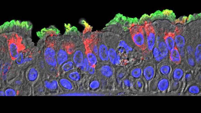 Researchers Map SARS-CoV-2 Infection in Cells of Nasal Cavity, Bronchia, Lungs