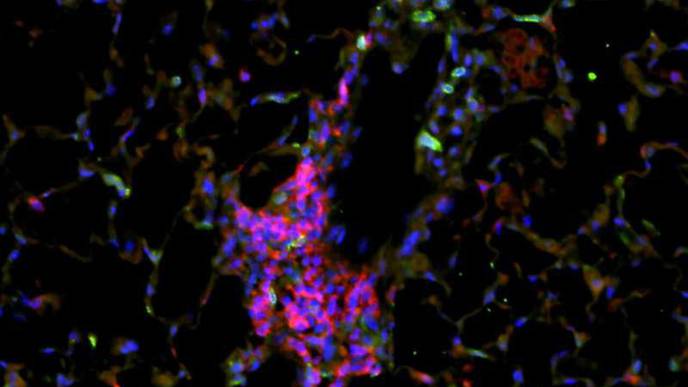 Promising Therapeutic Approach Against Chronic Obstructive Pulmonary Disease