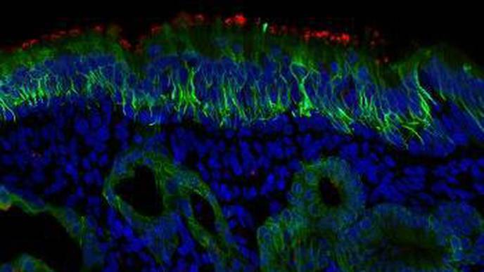 Study Adds to Evidence That Cells in the Nose Are Key Entry Point for SARS CoV-2