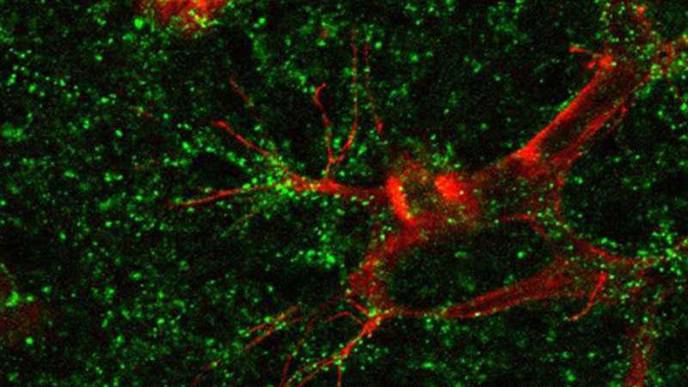 New Strategy for Treating Common Retinal Diseases Shows Promise