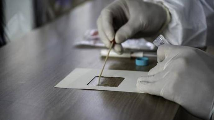 Environmental Surface Testing in Inpatient & Outpatient Hematology/Oncology Settings Shows Negligible Detection of SARS-CoV2