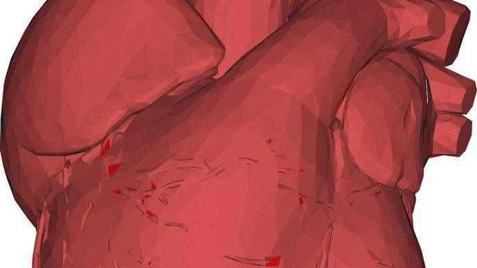 COVID-19 Linked To Cardiac Injury, Worse Outcomes For Patients With Heart Conditions