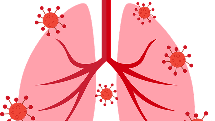 CBD Helps Reduce Lung Damage from COVID-19 by Increasing Levels of Protective Peptide