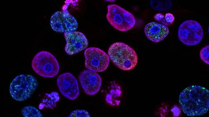 New Study Describes Which Cancer Patients are More Vulnerable to Coronavirus