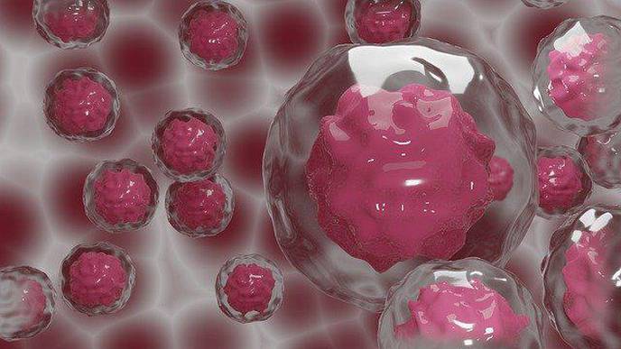 Amniotic Fluid Stem Cells May Lead to Better Treatment for Ischemic Stroke