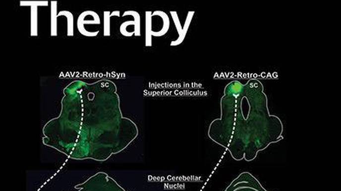 Gene Therapy for Placental Insufficiency Moves Toward the Clinic