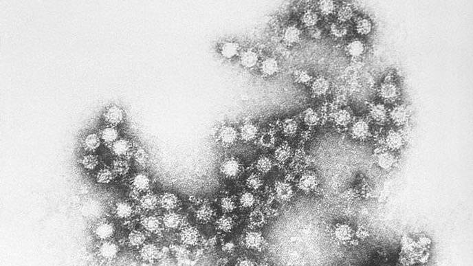 Cancer-Killing Treatment Using a Common Cold Virus Offers Hope to Patients with Inoperable Tumors