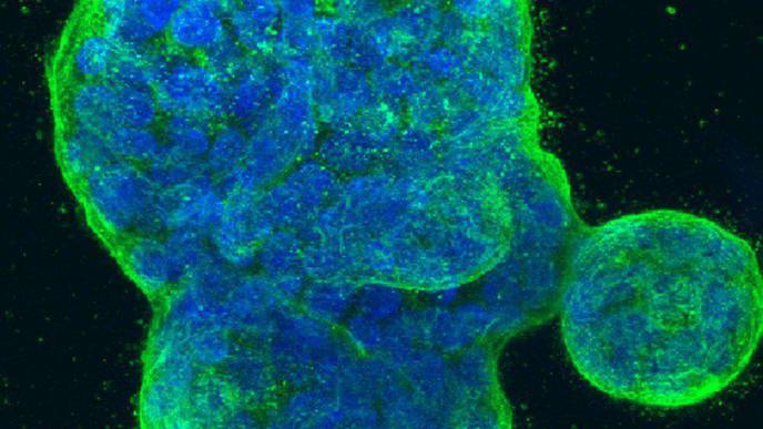 New Research Shows Breast Cancer Treatment in Patients Over Age 70 Can Be Safely Reduced