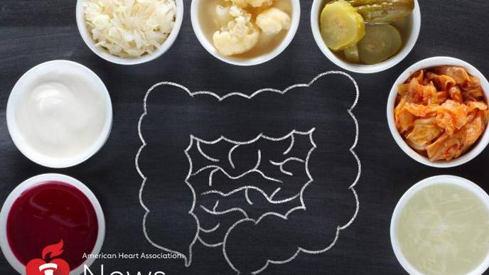 As Fermented Foods Rise in Popularity, Here's What Experts Say
