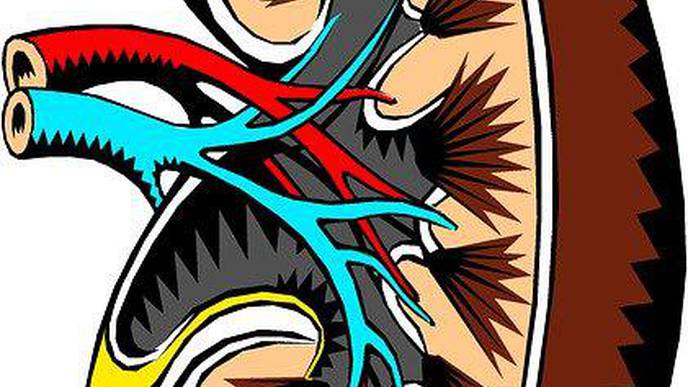 Proteinuria Reduction Slows Kidney Decline in Patients With Focal Segmental Glomerulosclerosis