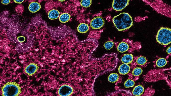 Genes May Leave Some People More Vulnerable to Severe COVID-19
