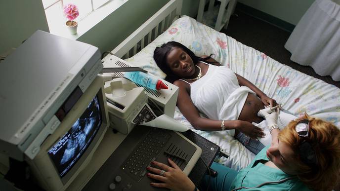 Examining the Black U.S. Maternal Mortality Rate & How to Cut It