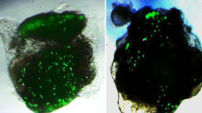 Human Lung & Brain Organoids Respond Differently to SARS-CoV-2 Infection in Lab Tests
