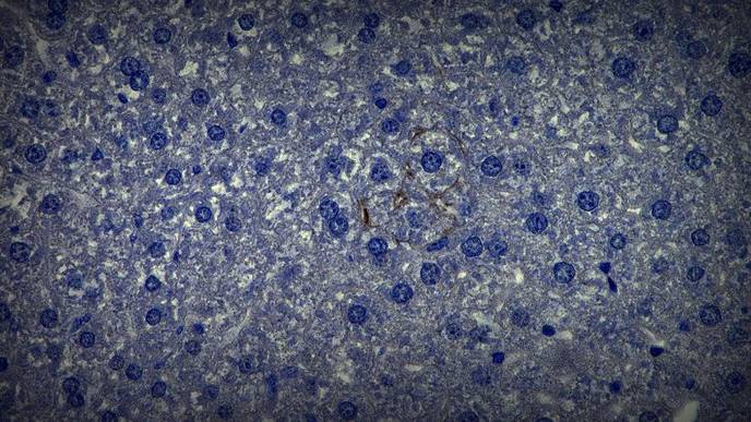 Study Shows Main Cell Type in the Liver Has Key Role in Defending Against Some Viruses