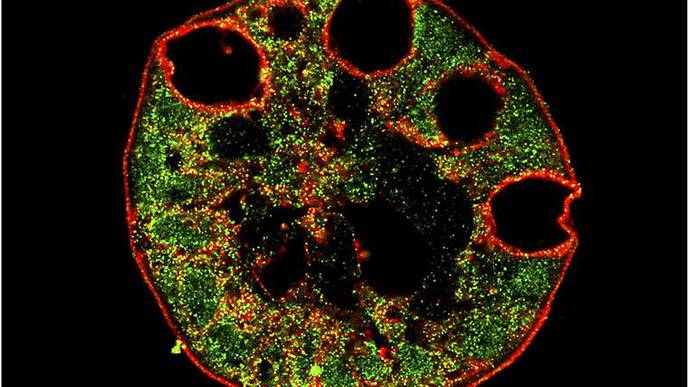For Some, GI Tract May Be Vulnerable to COVID-19 Infection