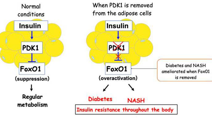 Mechanism Underlying the Development of Diabetes & Fatty Liver Illuminated