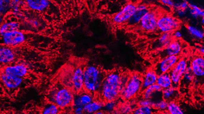 Nerves Keep Pancreatic Cancer Cells from Starving