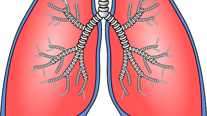 Radiation Therapy Can Cause Pulmonary Artery Thrombosis