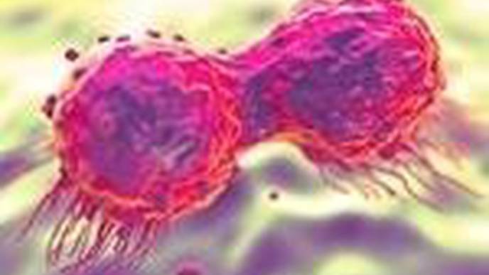 Drug Used to Treat Breast & Ovarian Cancer Can Transform Treatment for Prostate Cancer