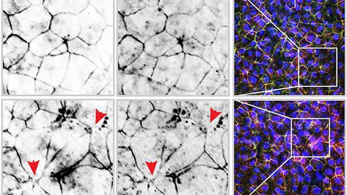 E-Cigarettes Trigger Inflammation in the Gut