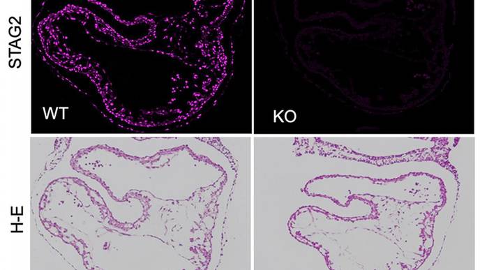 Researchers Find Clues to Clarify Why Cohesine Has a Role in Cancer & Cardiac Development