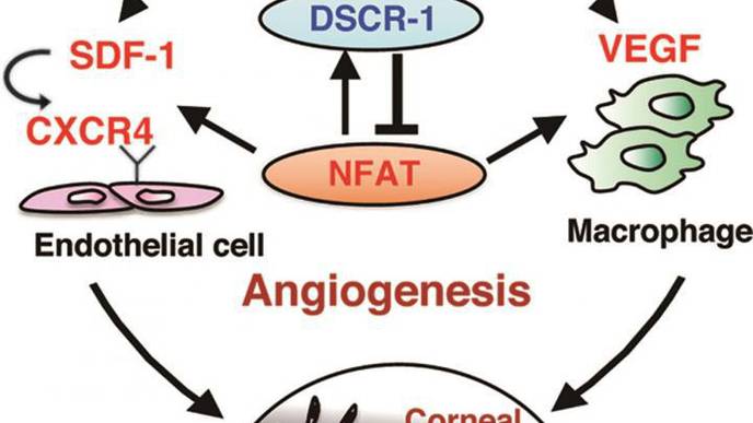 Down Syndrome-Associated Gene Suppresses Age-Related Corneal Clouding