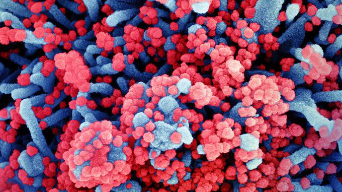 Higher Viral Loads Can Increase Mortality Rate in Patients Hospitalized with COVID-19 & Cancer