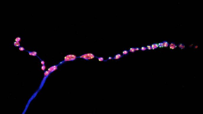 Brain 'Noise' Keeps Nerve Connections Young