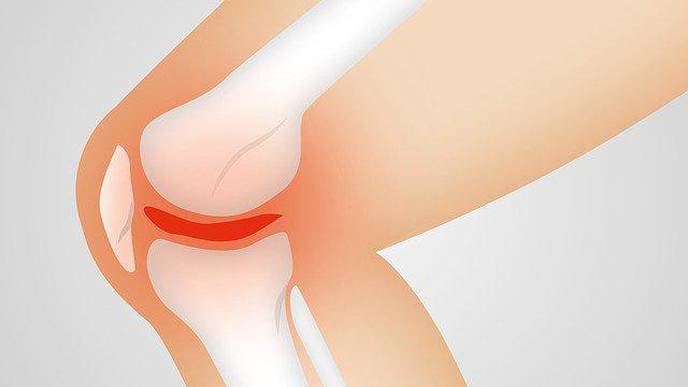 Osteoarthritis: New Trial Drug Has Powerful Anti-Inflammatory Effect
