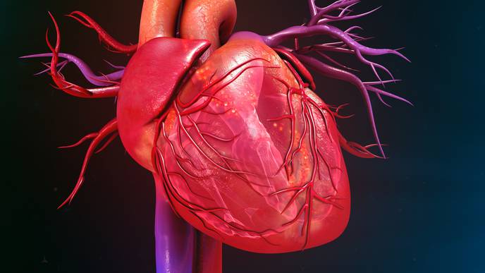 Treatment Shows Reduction in Heart Failure After Myocardial Infarction