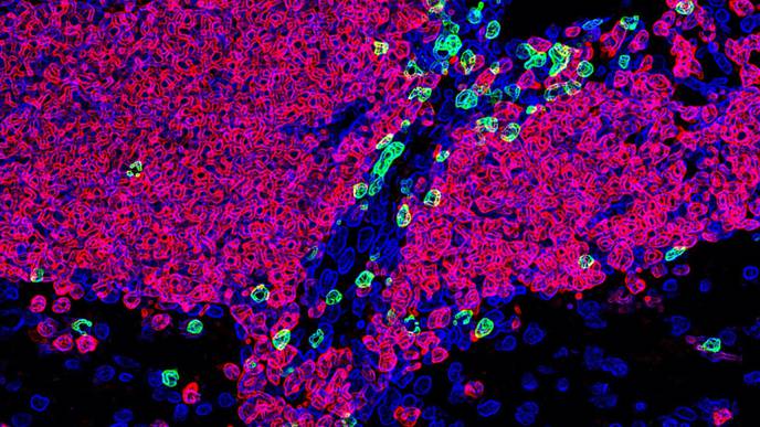 With Remarkable Similarities to MS, a Disease in Dogs Opens New Avenues for Study