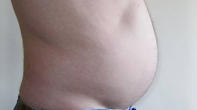 Link Between High Levels of Belly Fat & Prostate Cancer Death Risk