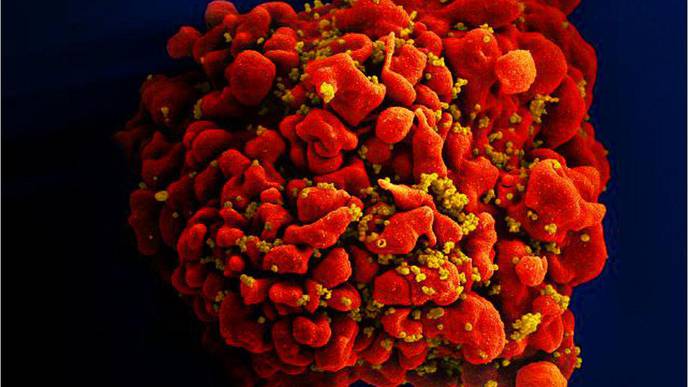 Researchers Devise More Efficient, Enduring CAR Gene Therapy to Combat HIV