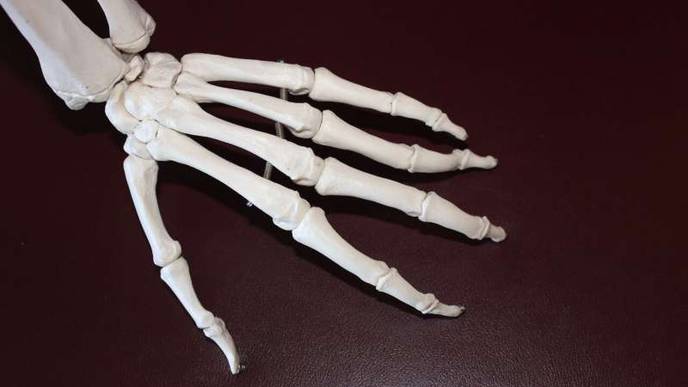 FDA Approves New Wrist Replacement Device to Relieve Arthritis Pain
