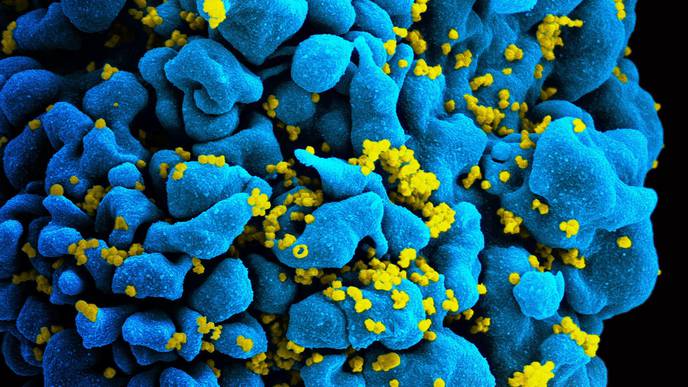 New Clues to the Conundrum of Mother-to-Child HIV Transmission