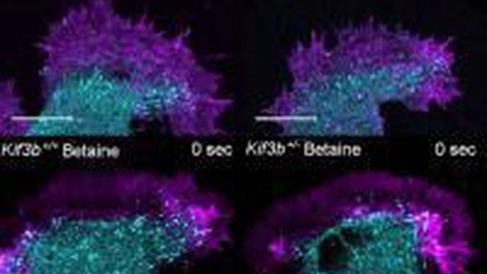 Supplement Treats Schizophrenia in Mice, Restores Healthy "Dance" & Structure of Neurons