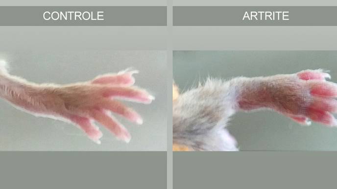 Lab-Created Molecule Achieves Positive Results in the Treatment of Arthritis