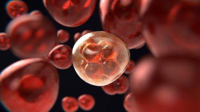 Innovative Technique Developed to Destroy Cancerous Kidney Cells
