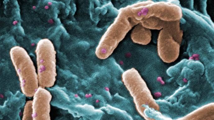 Stress Test Finds Cracks in Resistance of Harmful Hospital Bugs