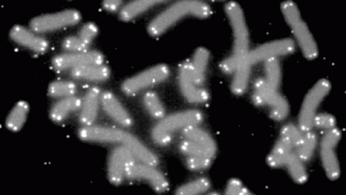 Self-Reported Daytime Sleepiness Is Associated with Telomere Shortening