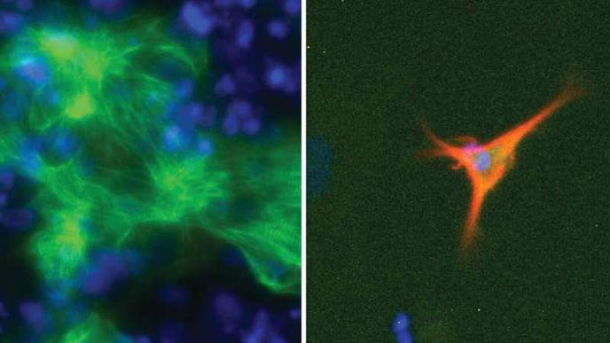 Computational Approach to Optimize Culture Conditions Required for Cell Therapy