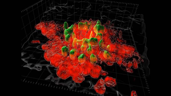Scientists & Surgeons Discover Cause of Excess Post-Surgical Scars