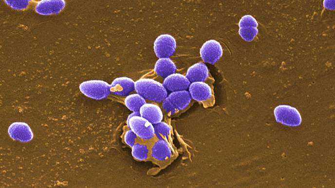 New Insights Into the Virulence Arsenal of a Common Hospital Pathogen