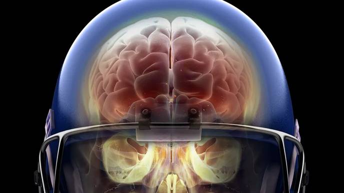Light Therapy is Safe, Modulates Brain Repair, & May Benefit Patients With Moderate TBI