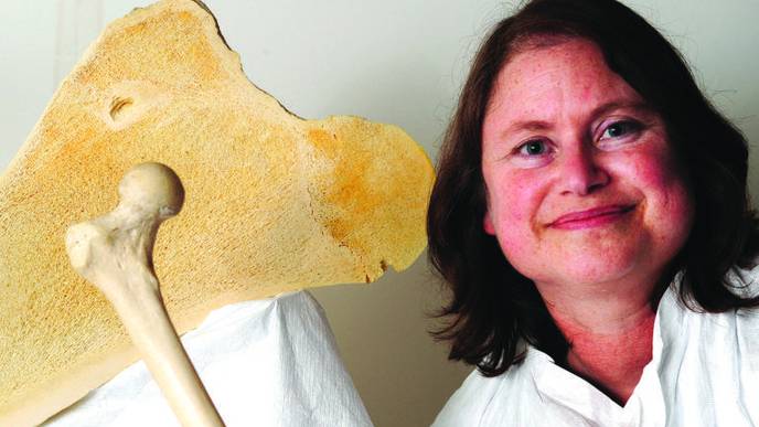 Radioactive Bone Cement Found to Be Safer in Treating Spinal Tumors