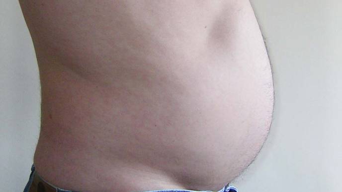 Link Between High Levels of Belly Fat & Prostate Cancer Death Risk